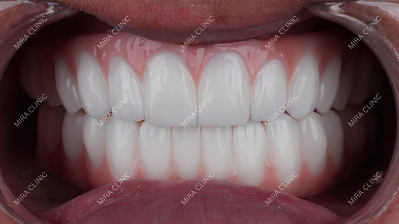 Real Patient Results
